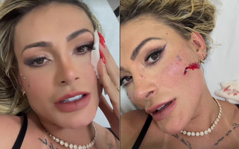 Andressa Urach leva tapa na cara